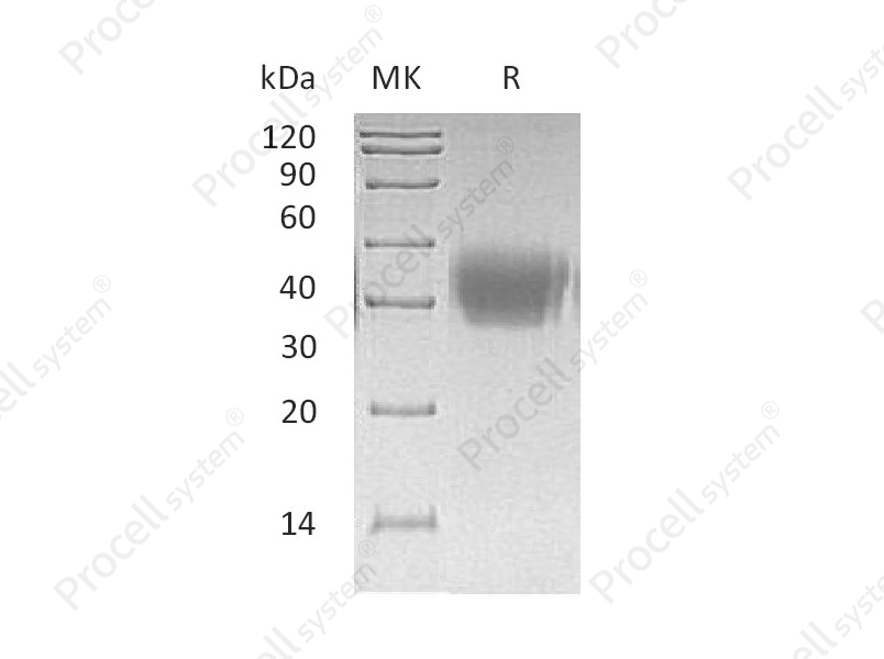 ACVR2A (C-6His), Human, Recombinant