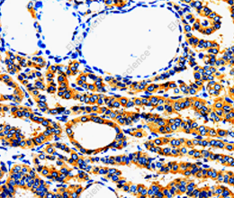 AIMP2 Polyclonal Antibody - 2