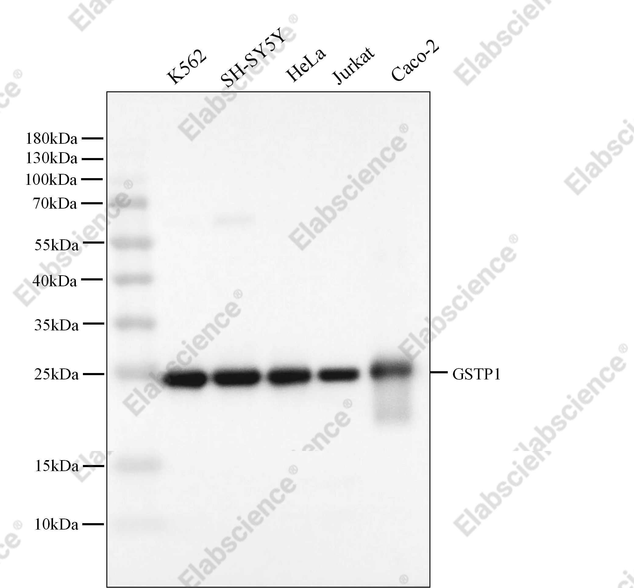 Recombinant GSTP1 Monoclonal Antibody - 2