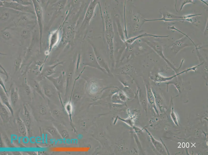 FTC-133 Cell Complete Medium - small - 5