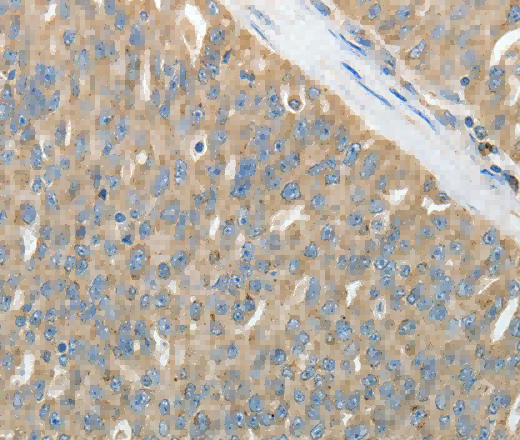 HSP90B1 Polyclonal Antibody - 3