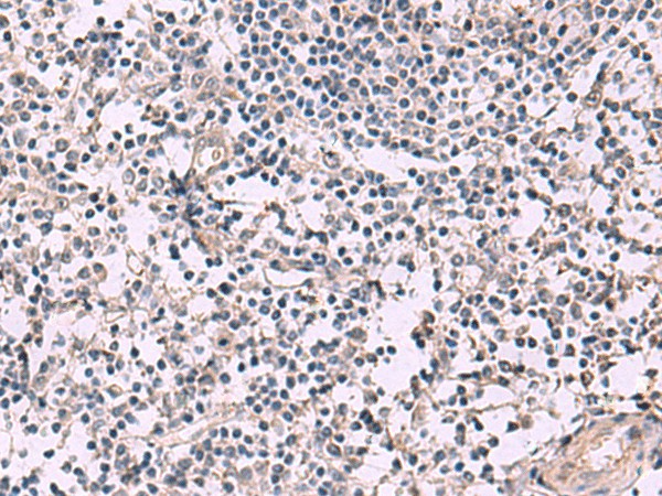 Immunohistochemistry of paraffin-embedded Human tonsil tissue  using KCNIP1 Polyclonal Antibody at dilution of 1:40(?200)