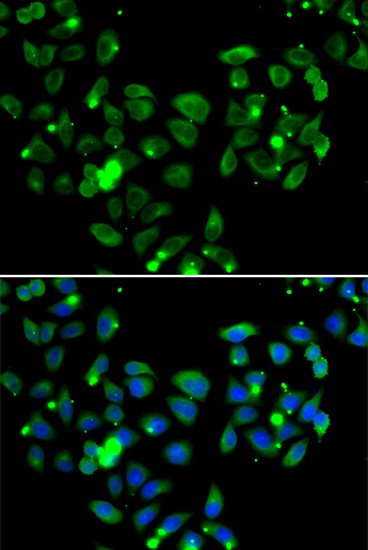 Immunofluorescence analysis of A549 cells using CARD11 Polyclonal Antibody Blue: DAPI for nuclear staining.