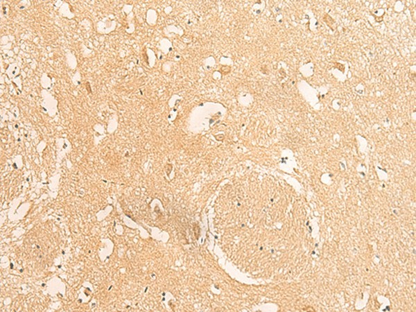 Immunohistochemistry of paraffin-embedded Human brain tissue  using IFITM2 Polyclonal Antibody at dilution of 1:25(?200)