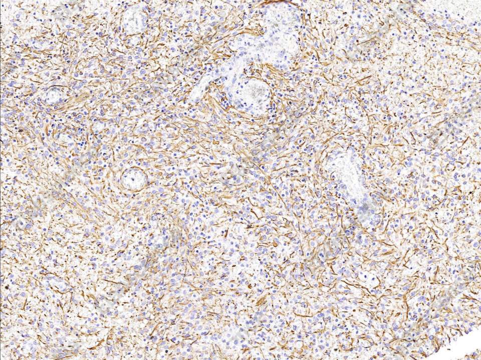 Recombinant GFAP Monoclonal Antibody - 1