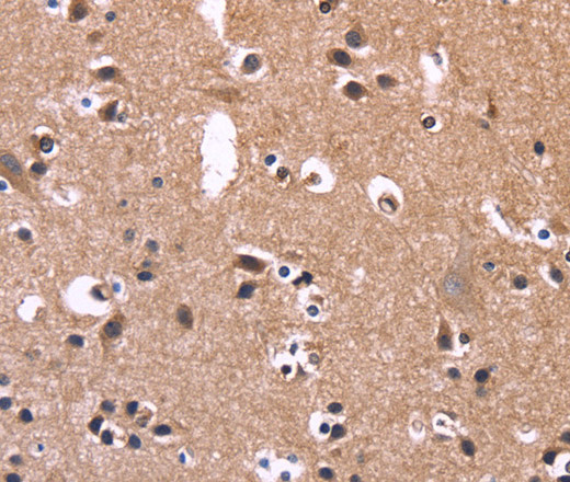 Immunohistochemistry of paraffin-embedded Human brain tissue using SELPLG Polyclonal Antibody at dilution 1:50