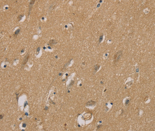 Immunohistochemistry of paraffin-embedded Human brain using RAD51 Polyclonal Antibody at dilution of 1:40