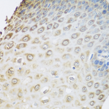 Immunohistochemistry of paraffin-embedded Human esophagus using GRPEL2 Polyclonal Antibody at dilution of  1:100 (40x lens).