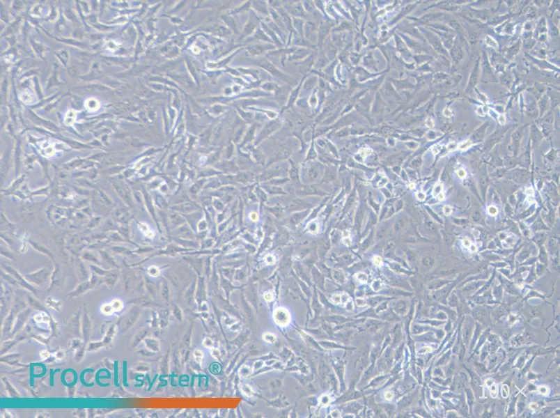 U251 Cell Complete Medium - 2