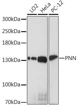 Western blot analysis of extracts of various cell lines using PNN Polyclonal Antibody at1:1000 dilution.