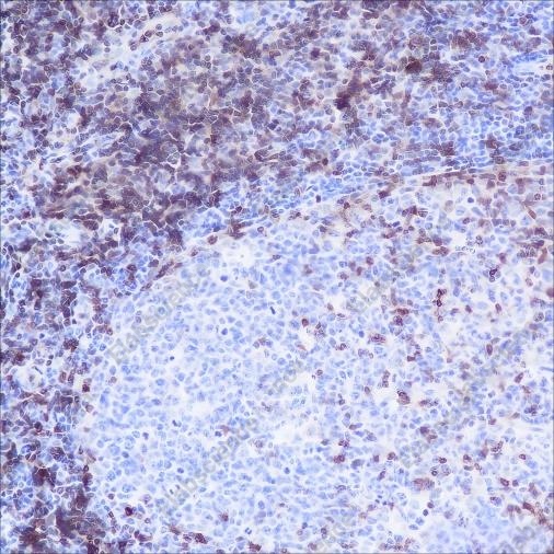 Recombinant CD3G Monoclonal Antibody - 2