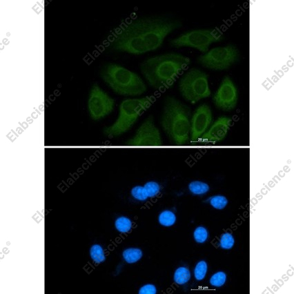 Recombinant ATP citrate lyase Monoclonal Antibody - 2