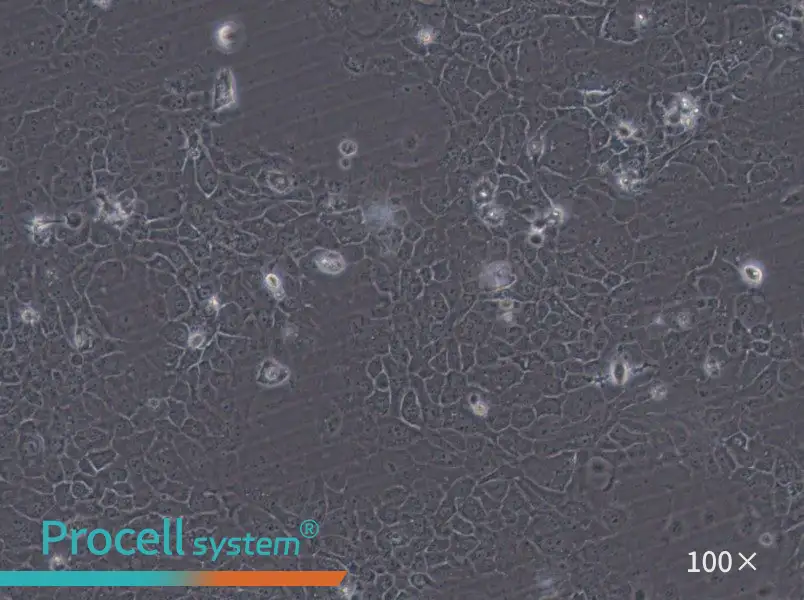 SCaBER Cell Complete MediumSCaBER Cell Complete Medium - 2