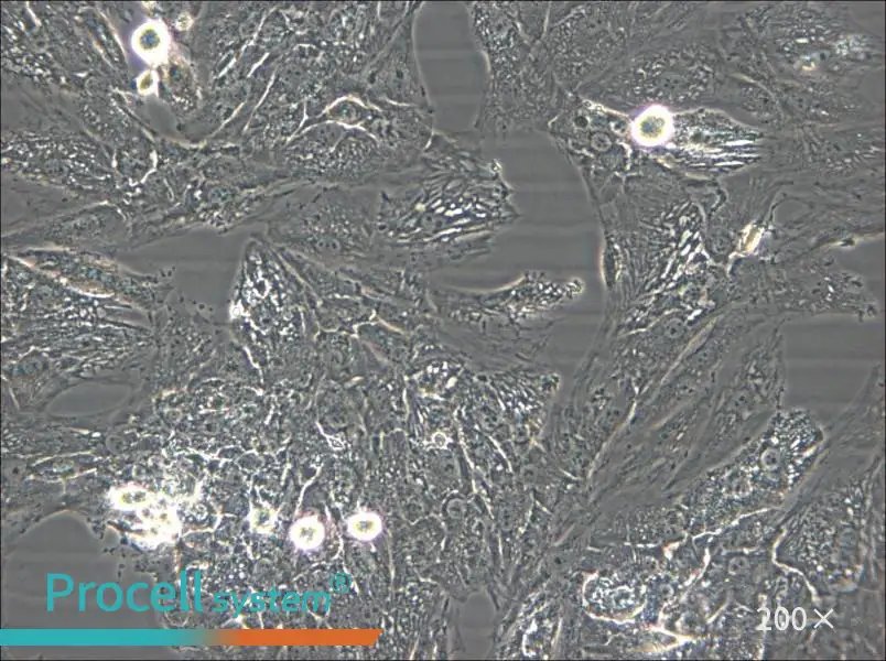 UM-Chor1 Cell Complete Medium - 6