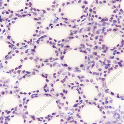 Recombinant PAX8 Monoclonal Antibody - 3