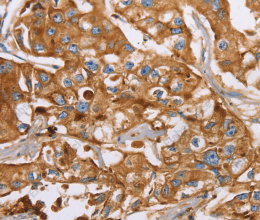 LTF Polyclonal Antibody - 2
