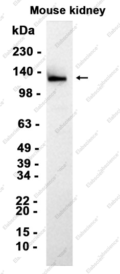 Recombinant Integrin alpha 6 Monoclonal Antibody - 1
