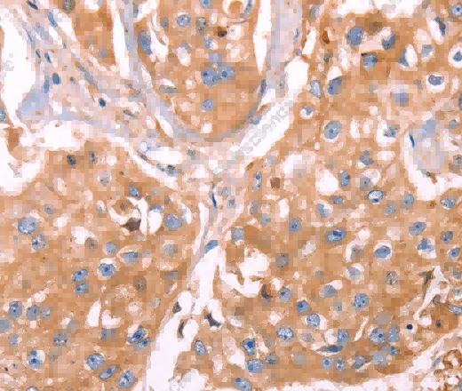 GC Polyclonal Antibody - 3
