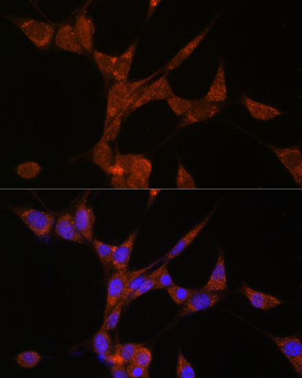 Immunofluorescence analysis of NIH/3T3 cells using AKR1C3 Polyclonal Antibody at dilution of  1:100. Blue: DAPI for nuclear staining.