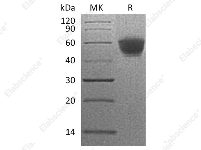 Recombinant Human NKG2D/CD314 Protein (Fc Tag) - 1