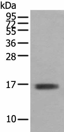 Western blot analysis of Mouse skeletal muscle tissue  using TNNC1 Polyclonal Antibody at dilution of 1:400