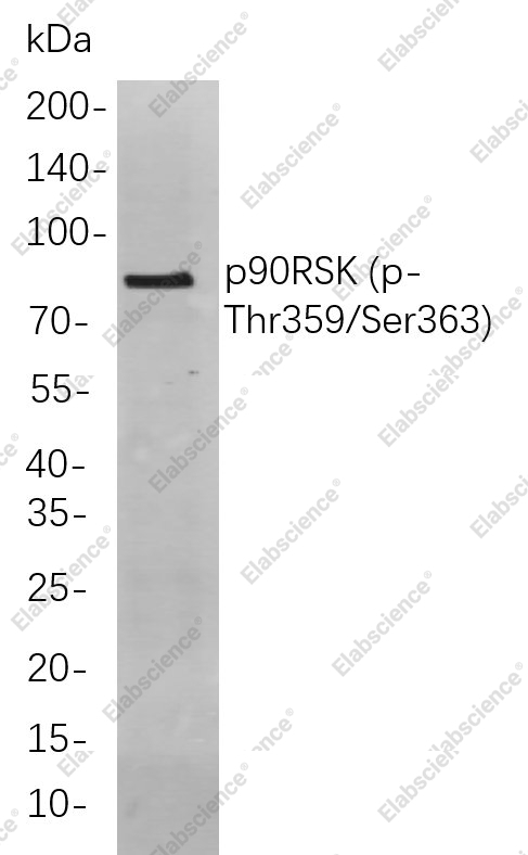 Recombinant Phospho-p90RSK（Thr359, Ser363) Monoclonal Antibody - 1