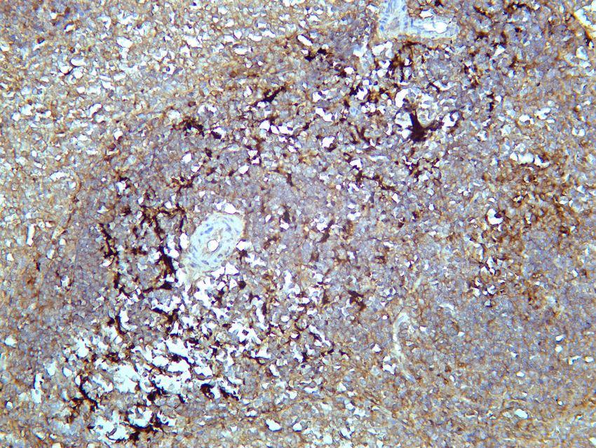 Recombinant SQSTM1/p62 Monoclonal Antibody - small - 5