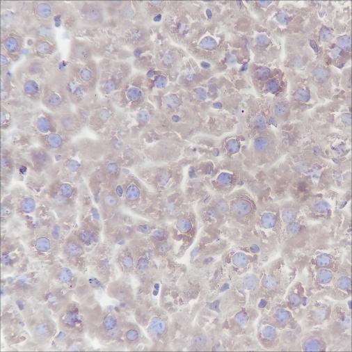 Recombinant PTGER2 Monoclonal Antibody - 3