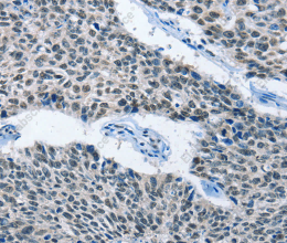 ELAVL1 Polyclonal Antibody - 2