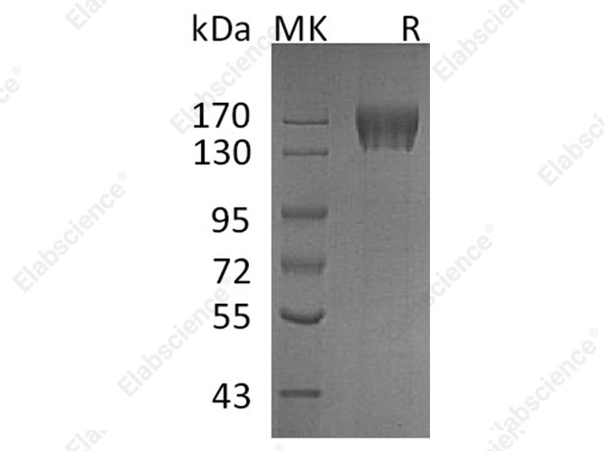 Recombinant Human c-KIT/CD117 Protein (His Tag) - 1