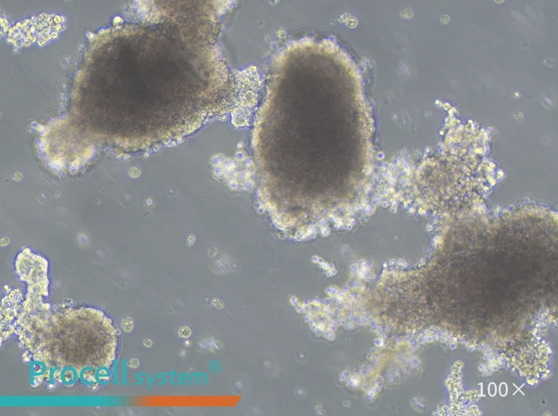 AtT-20 Cell Complete Medium - 1