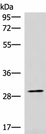 Western blot analysis of Hela cell lysate  using CDK4 Polyclonal Antibody at dilution of 1:1000