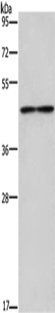 Western Blot analysis of Mouse heart tissue using IL5RA Polyclonal Antibody at dilution of 1:550