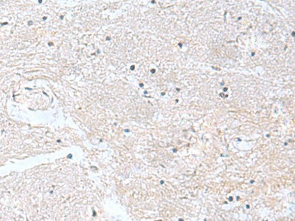 Immunohistochemistry of paraffin-embedded Human brain tissue  using CACNB1 Polyclonal Antibody at dilution of 1:100(?200)