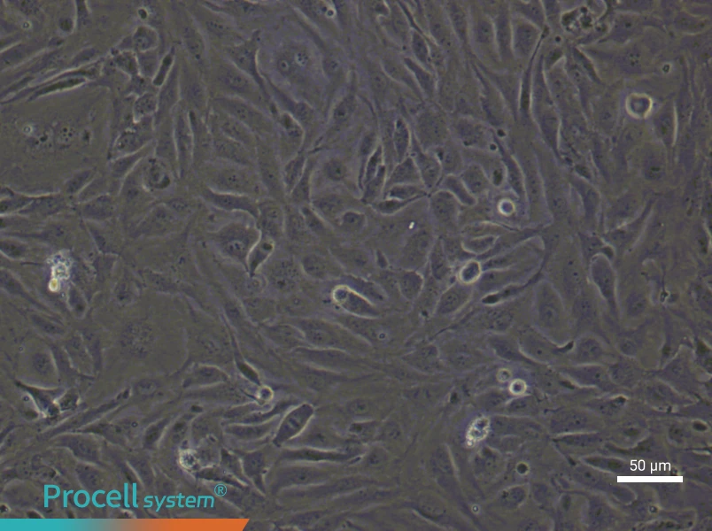 Human Lymphatic Endothelial (Primary cell immortalization) Cell Complete Medium - 5