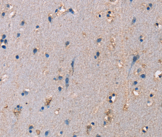 Immunohistochemistry of paraffin-embedded Human brain  tissue using ADAM29 Polyclonal Antibody at dilution 1:40