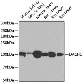 Western blot analysis of extracts of various cell lines using DACH1 Polyclonal Antibody at dilution of 1:1000.