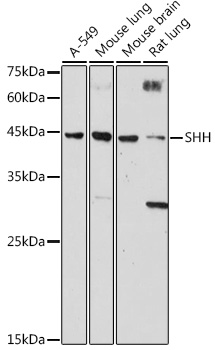 Western blot analysis of extracts of various cell lines using SHH Polyclonal Antibody at 1:1000 dilution.