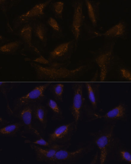 Immunofluorescence analysis of U-2 OS cells using SLC25A27 Polyclonal Antibody at dilution of  1:100. Blue: DAPI for nuclear staining.