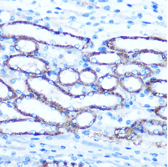 Immunohistochemistry of paraffin-embedded Mouse kidney using TBCCD1 Polyclonal Antibody at dilution of 1:100 (40x lens).Perform microwave antigen retrieval with 10 mM PBS buffer pH 7.2 before commencing with IHC staining protocol.