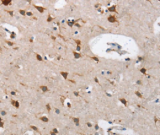 Cathepsin L Polyclonal Antibody - 2