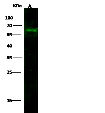 Recombinant CD14 Monoclonal Antibody-searchlist-1