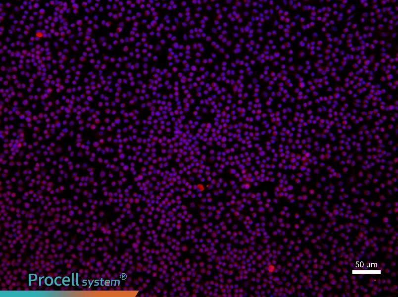 Rat Peritoneal Macrophage Complete Medium - 1