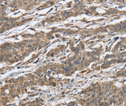 IPO7 Polyclonal Antibody - 2