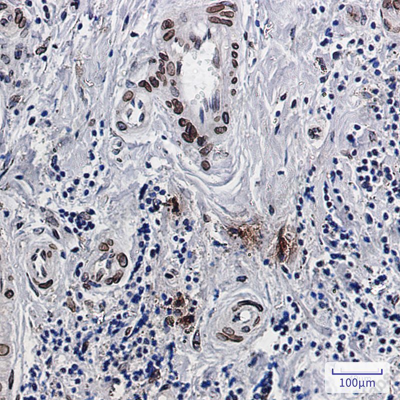 Recombinant Emerin Monoclonal Antibody - 3