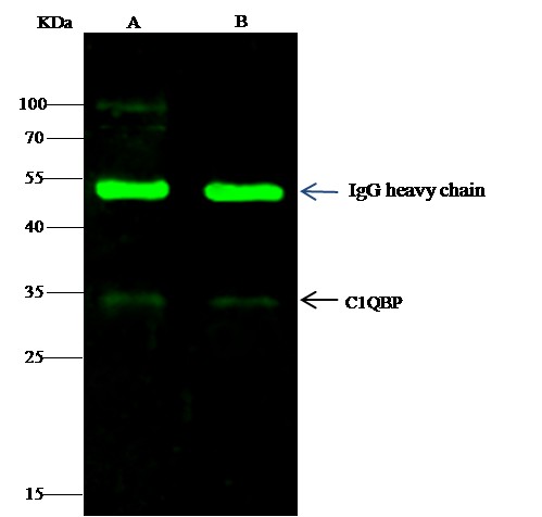 Recombinant C1QBP/HABP1 Monoclonal Antibody-searchlist-1