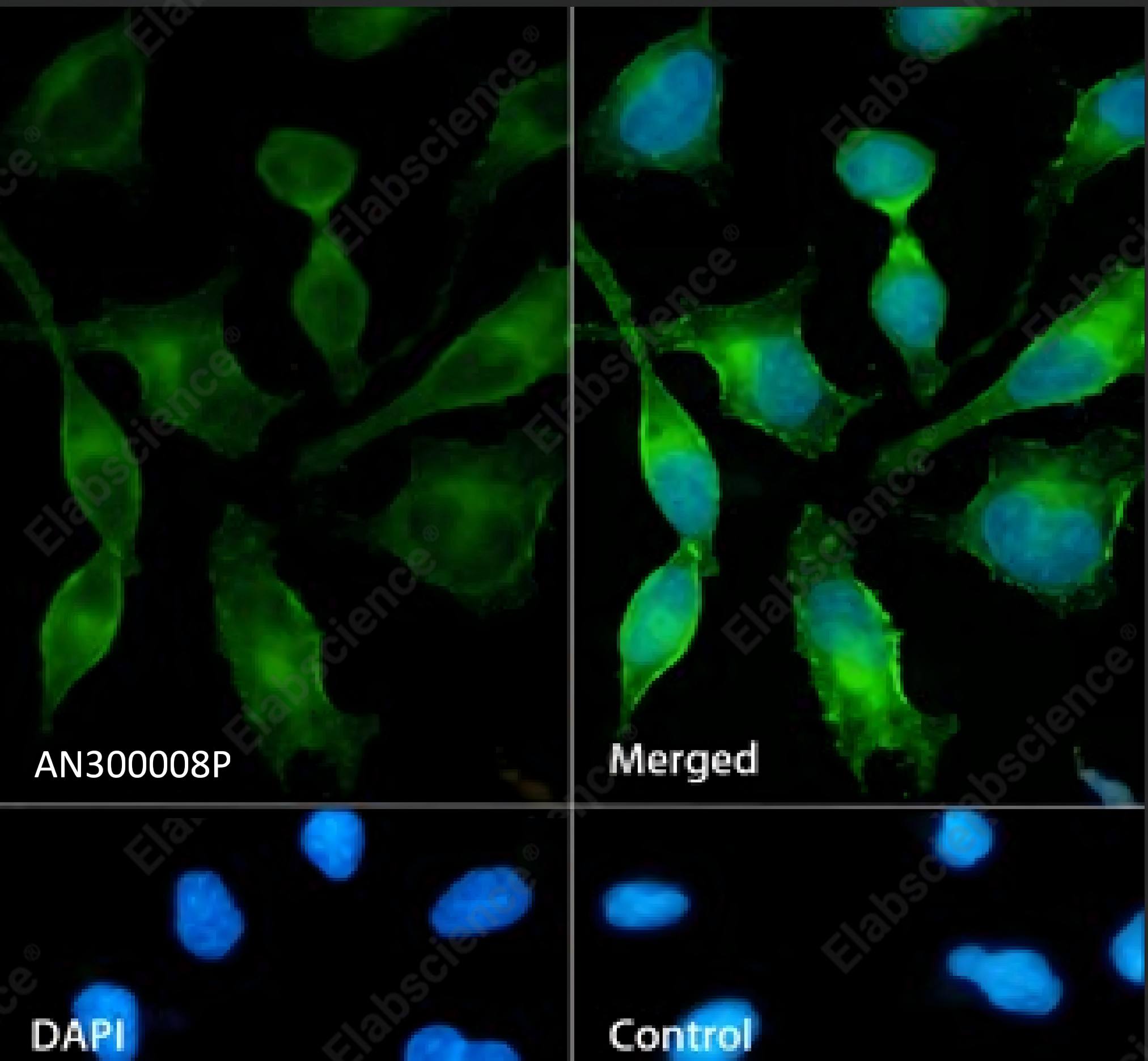 Recombinant EGFR/HER1/ErbB1 Monoclonal Antibody - 5
