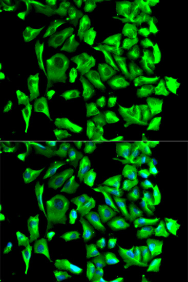 Immunofluorescence analysis of U2OS cells using HSP90AB1 Polyclonal Antibody. Blue:DAPI for nuclear staining.