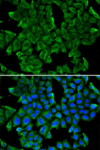 Immunofluorescence analysis of MCF-7 cells using REG3G Polyclonal Antibody