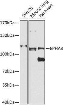 Western blot analysis of extracts of various cell lines using EPHA3 Polyclonal Antibody at 1:1000 dilution.